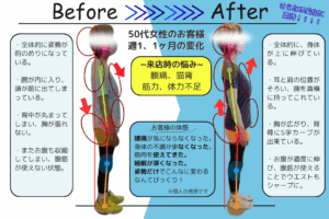 beforeafter2